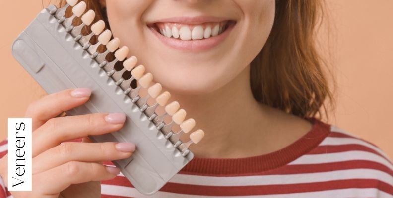 Carillas dentales en barcelona